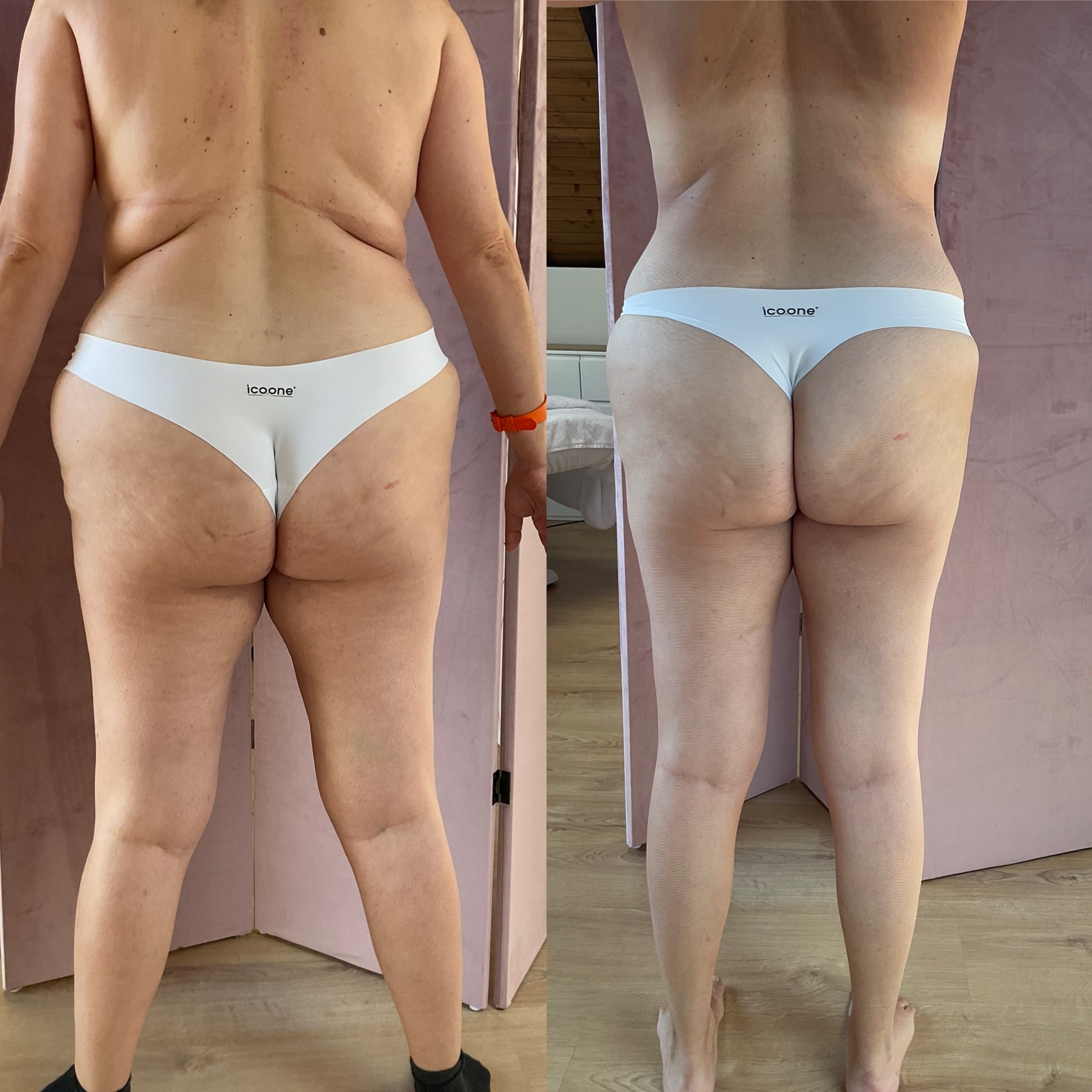 9863EF20-8802-415B-9A0F-E93CEAE29D11